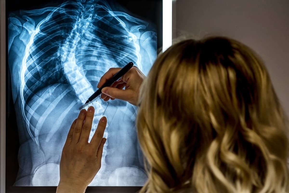 Skolyoz uzmanı doktor hastaların röntgenini çekiyor